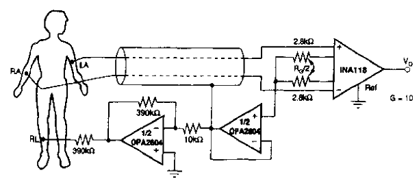 With right leg drive beat<strong>ECG</strong><strong>Circuit</strong>.gif