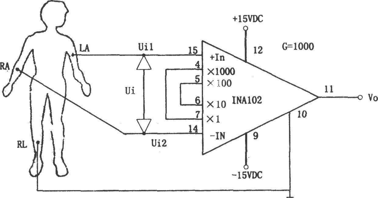 Human body bioelectric signal preamplifier composed of INA102